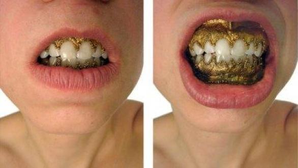 Lauren Kalman, Hard Wear (Oral Rims), 2006, Inkjet print, Courtesy of Sienna Patti Contemporary