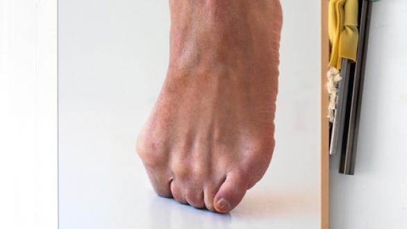 This is not my body # 2, 2017 118 x 91 x 7 cm, Impresión cromogénica sobre papel de algodón Hahnemuhle cristal, acero no normalizado, heridas no visibles, madera de haya, caucho y foam Pieza única