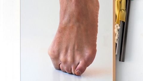 This is not my Body. Ixone Sádaba