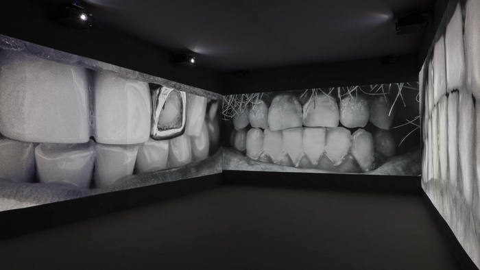 2068 dientes en la Galería Helga de Alvear